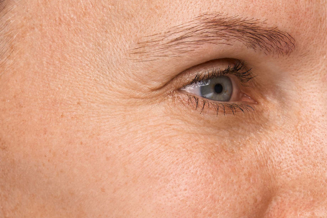 Close-up of a person's eye with visible skin texture